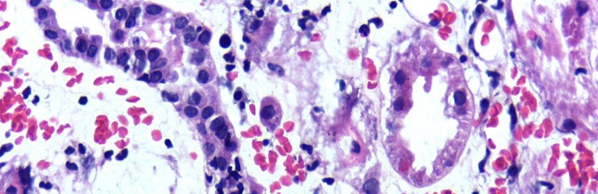 Nephrology cells
